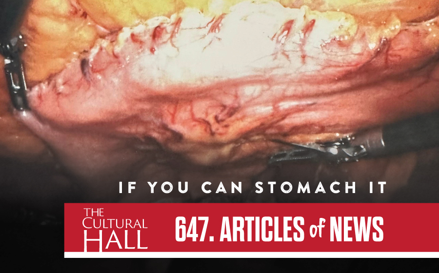 If you Can Stomach it – AoN Ep. 647 The Cultural Hall